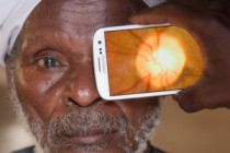 Eyesight Checks with Your Phone