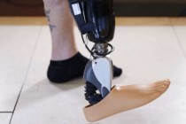 Brain Controlled Prosthetic Limbs have Arrived